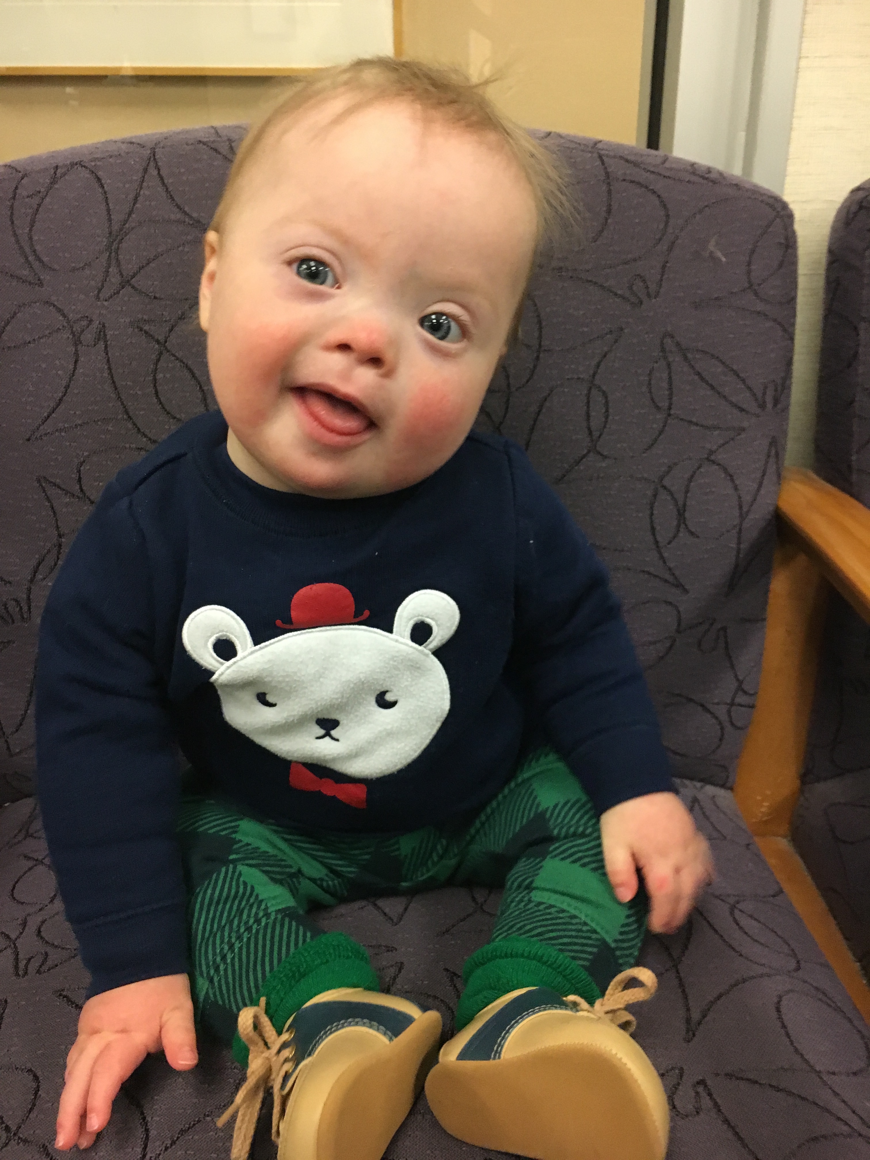 baby with down syndrome sitting in a chair smiling