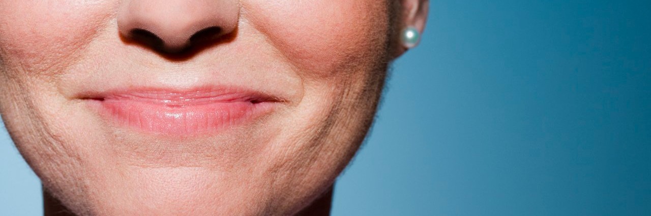 Crohn's Disease: The Pain I'm Hiding Behind My Smile woman half smiling