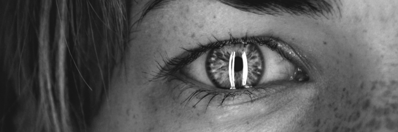 It's Time to Change our 'Black and White' View of Depression close up of a woman