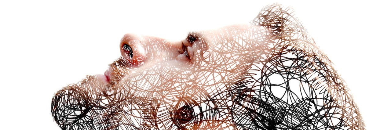 The Amazing Side of Bipolar Disorder man's head