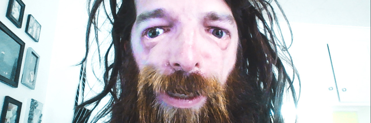 I'm Not 'Brave' for Having a Disability Greg Burkholder.