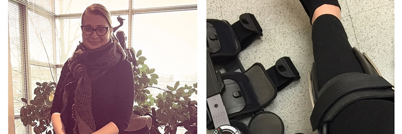 Looking for a Job With a Newly Acquired Disability Andrea.