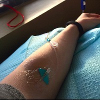 arm with iv line in it