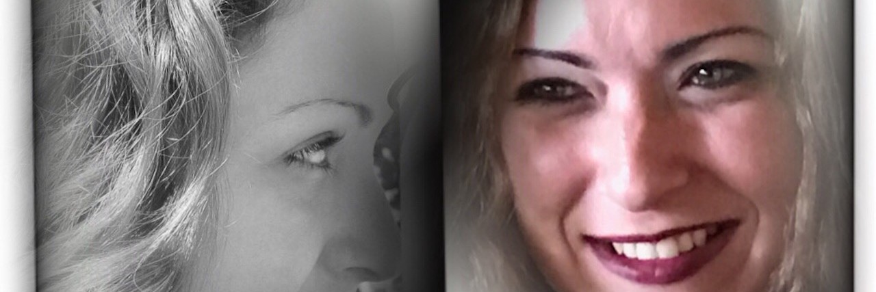 The Symptoms of Borderline Personality Disorder You Don't See two photos of contributor side by side, mirrored