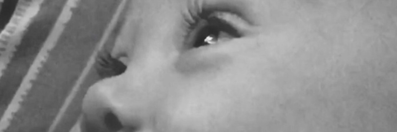 Facing My Daughter's Heart Surgery This Year Black and white photo of baby girl