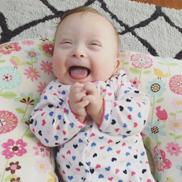 newborn baby with down syndrome