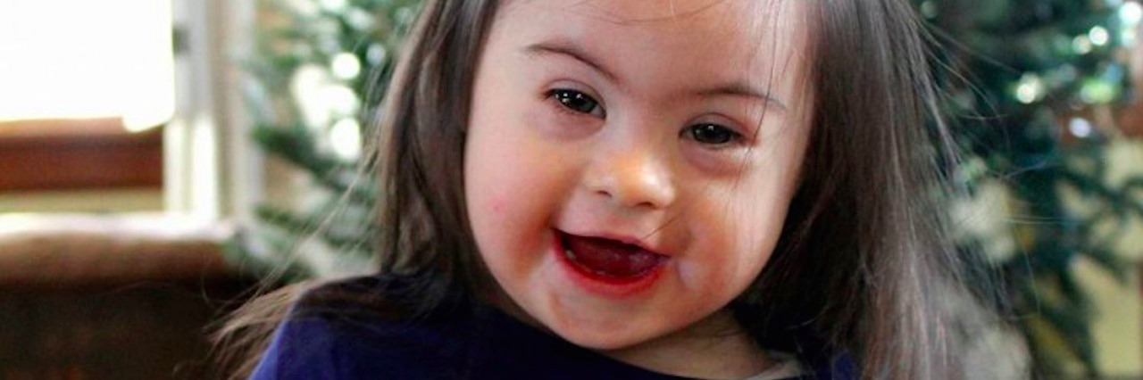 25 People With Down Syndrome Show Off Their Individuality little girl with down syndrome in front of christmas tree