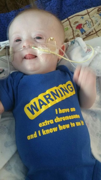 baby with down syndrome wearing shirt that says warning i knonw i have an extra chromosome and i know how to use it