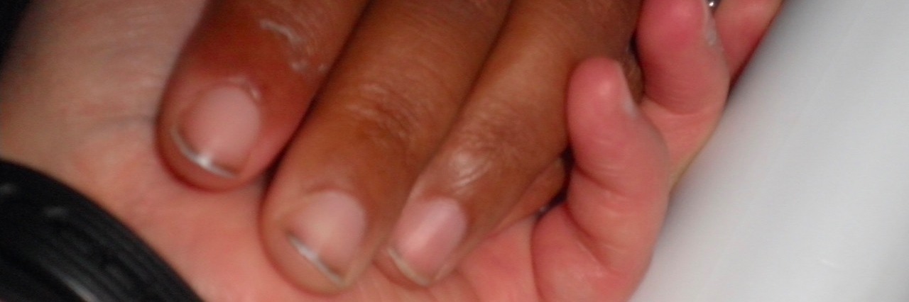 Lessons About Friendship and Mental Illness Two people holding hands