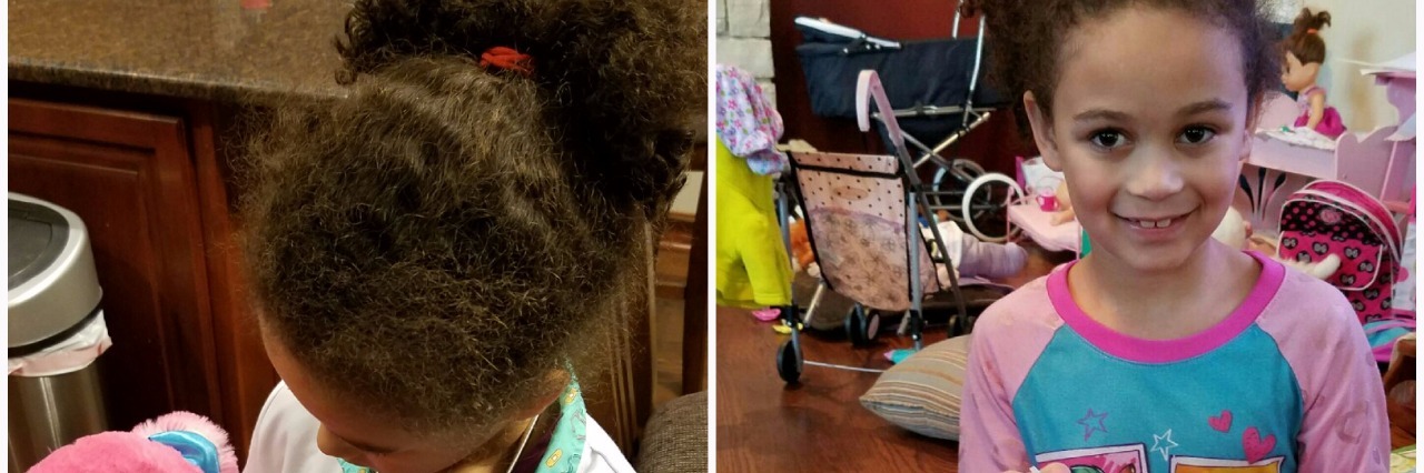 7 Pictures Showing How Life Can Be Affected by Propionic Acidemia kids playing doctor with toys