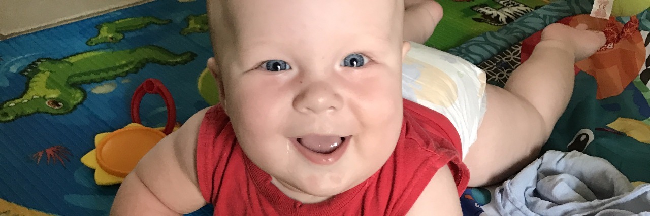 Taking My Medically Complex Son to Playgroup With Rheumatoid Arthritis baby boy crawling on the floor and smiling