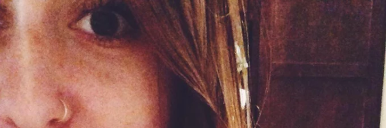 Why I'm Not Afraid to Show My Self-Harm Scars in Photos Anymore Contributor Facebook photo with scars on arm