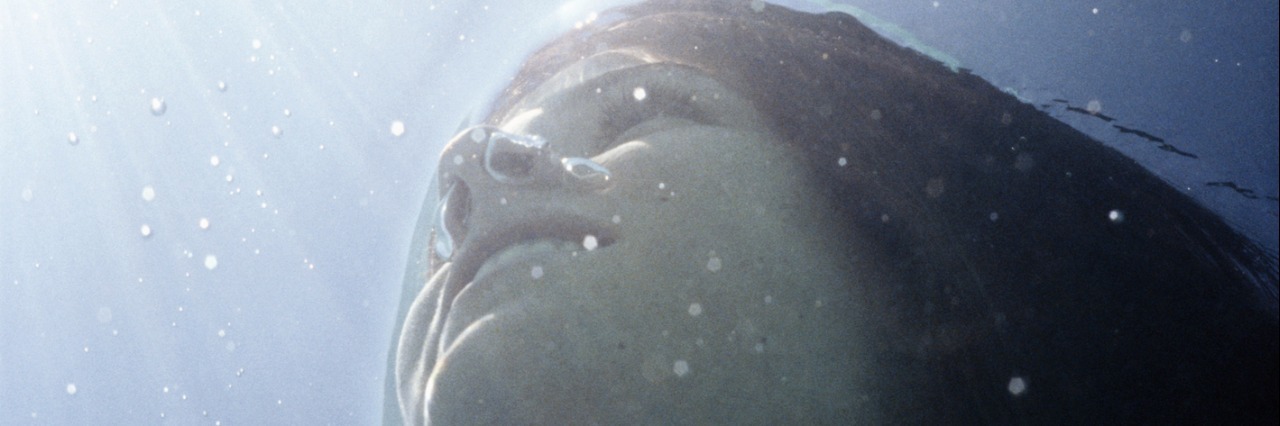 What I Want Other People With Fibrous Dysplasia to Know Young woman under water, low angle view