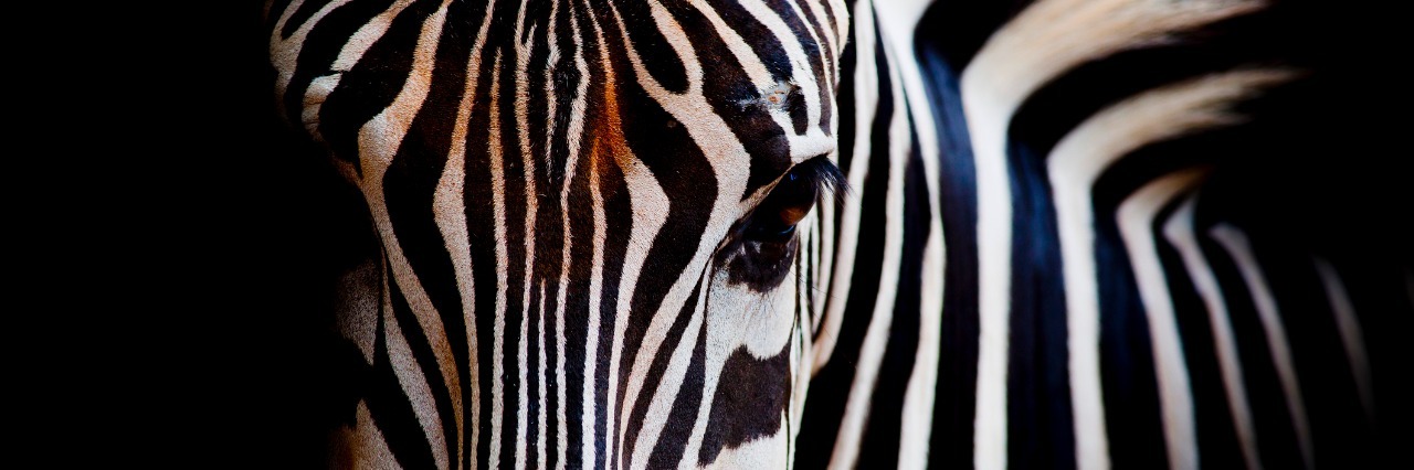 Doctors: Ignore the Prognosis of the Disease, and Save My Child head of a zebra