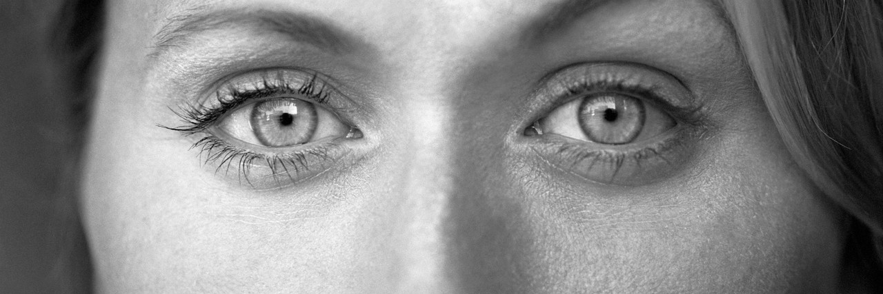 PTSD: When You Feel Unworthy of Therapy close up of a woman's face