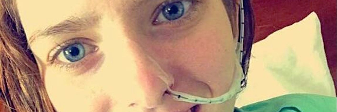 Rheumatoid Arthritis, SMAS: What I Mean When I Say 'I'm Fine' woman smiling with a tube in her nose