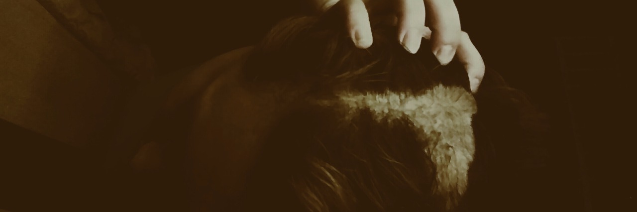 The Unexpected Lesson I Learned From Kids About Trichotillomania Woman with bald spot grabbing hair trichotillomania