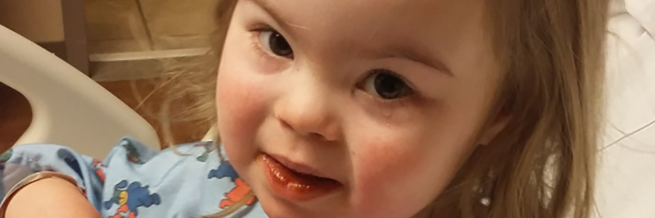 What Doctors Didn't Tell Me About My Daughter's Down Syndrome Willow recovering in the hospital but looking cheerful.