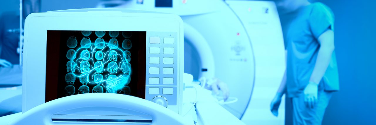 MRI scan and computer showing the brain