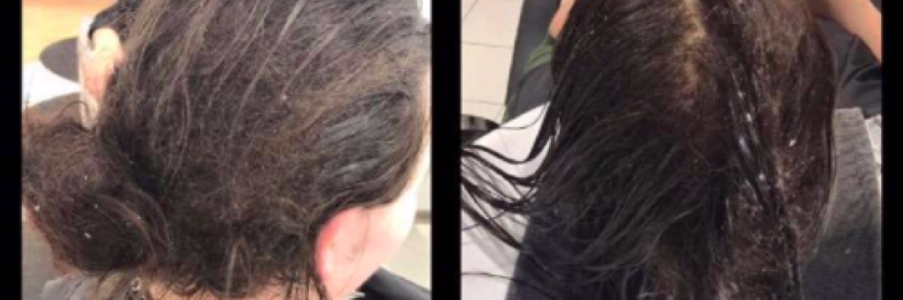 Kate Langman Styles Woman With Depressions Hair at Ulta Beauty Before photos of woman's matted hair.