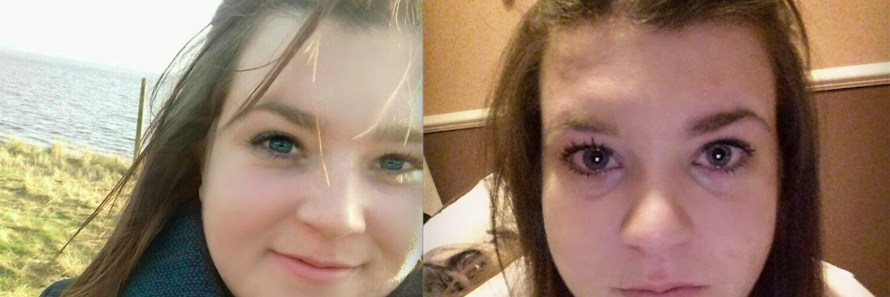 Hiding Depression: The Me I Let You See, and the Real Me split screen of girl smiling and girl crying