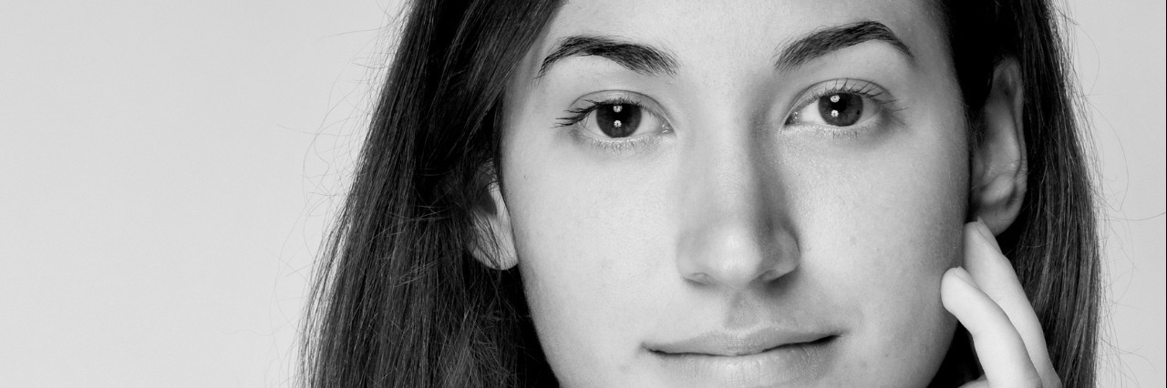 How I View My Scars From Self-Harm face shot of young woman.