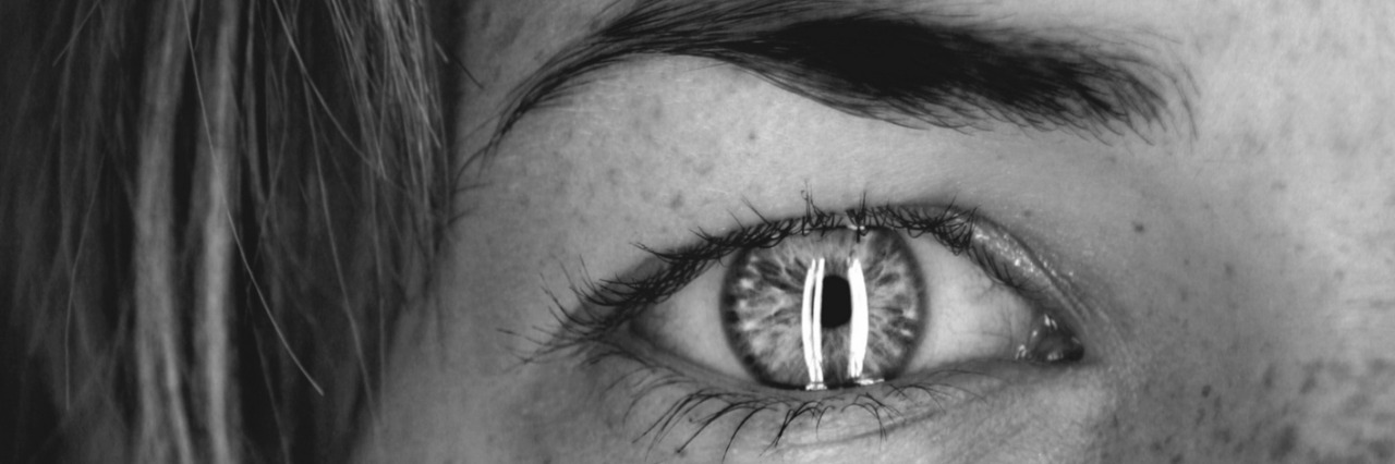 Borderline Personality Disorder: What Is Black-and-White Thinking? woman's eye