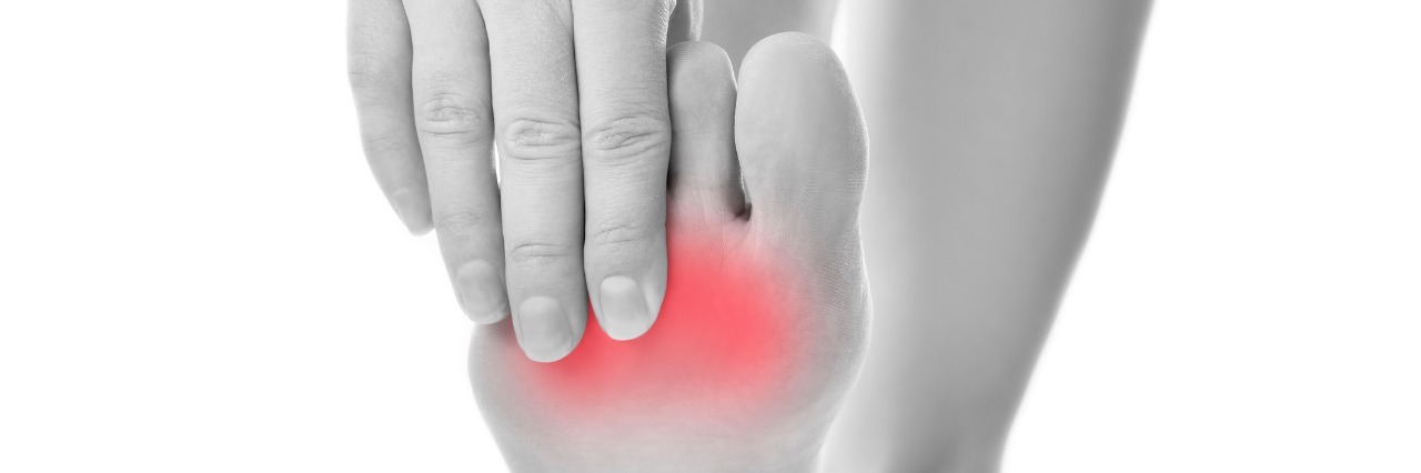 Simple Way to Explain Complex Regional Pain Syndrome