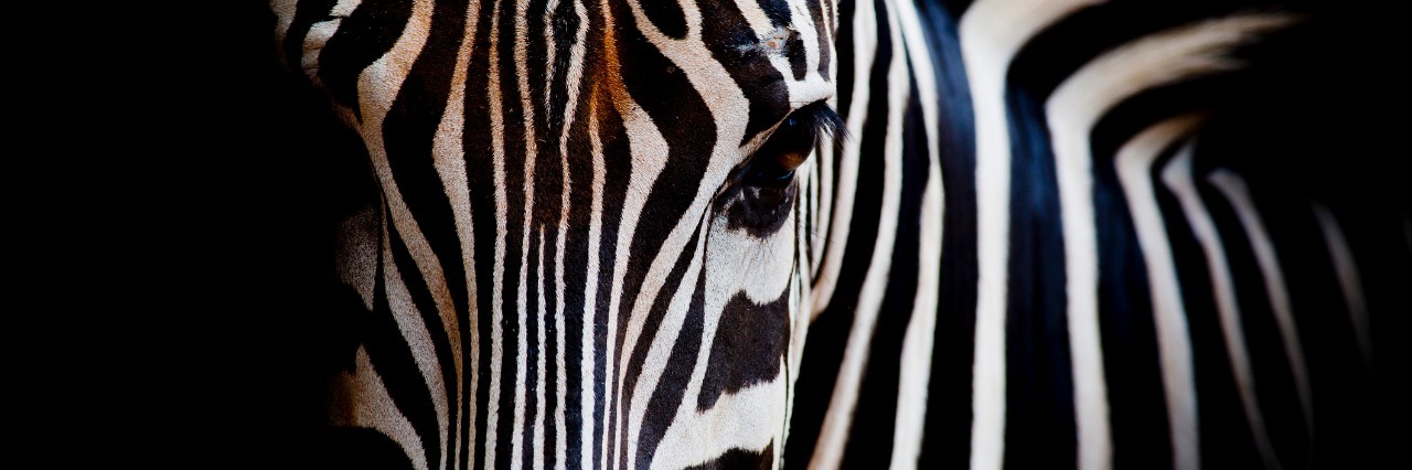When Doctors Are Afraid to Talk About Ehlers-Danlos Syndrome headshot of a zebra