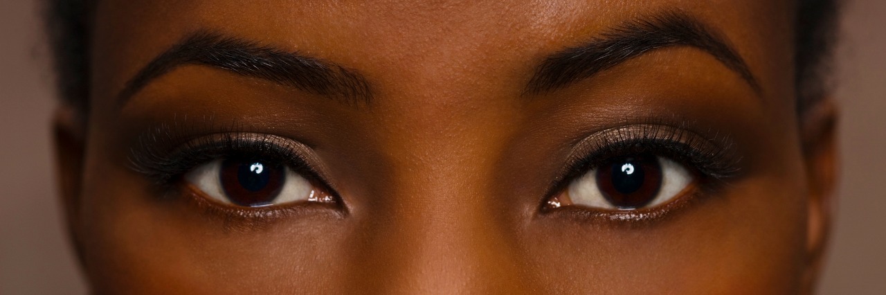 Why I Don't Consider My Ehlers-Danlos Syndrome an 'Invisible Illness' woman's face looking straight ahead