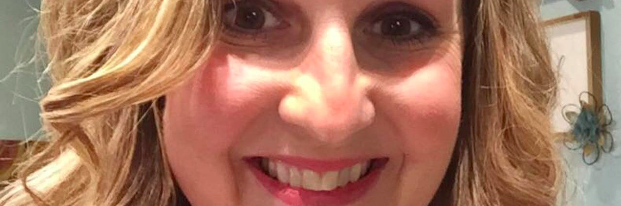 How I'm Treated Differently Since Telling People I Have Lupus kristin klontz