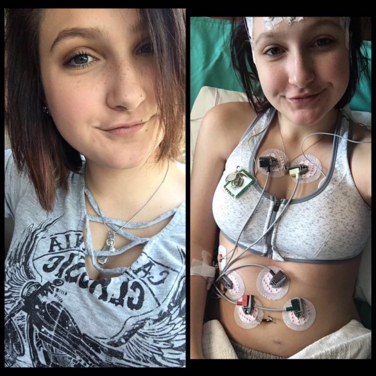 photo of woman smiling and photo of her wearing monitors on her chest and stomach