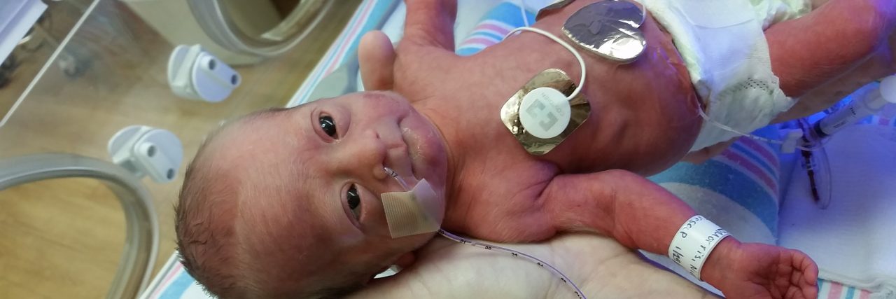 Thanking the NICU for Helping Our Premature Baby With Down Syndrome Adam's son in the NICU.