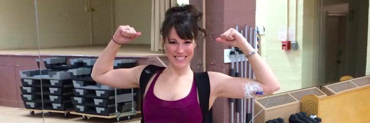 15 Photos That Show What Gastroparesis Really Looks Like emilie leblond showing muscles and feeding tube