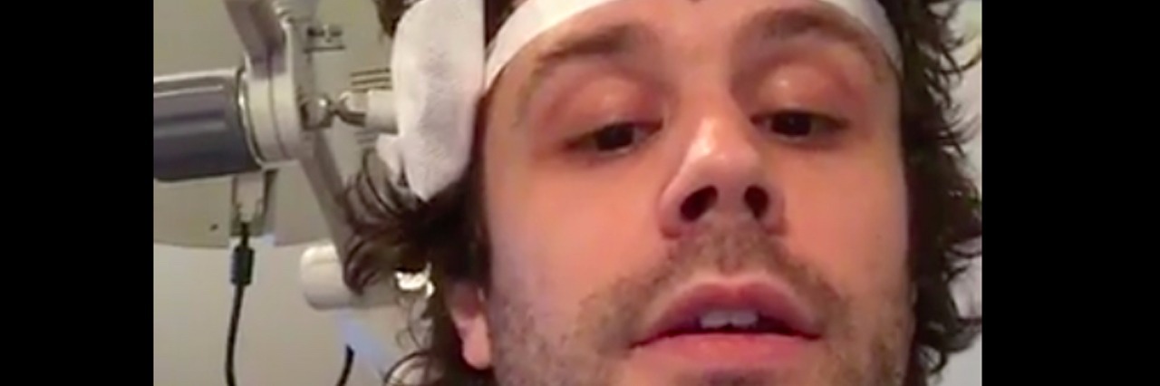 Passion Pit Uses Facebook Live to Show TMS for Bipolar Disorder Michael Angelakos with white TMS tape on his head.