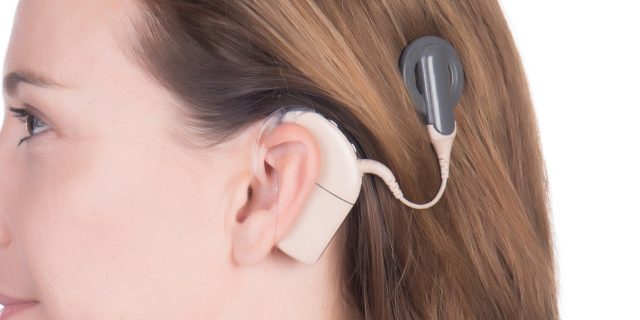 7 Pros and Cons of Cochlear Implants for Adults Young woman with cochlear implant.
