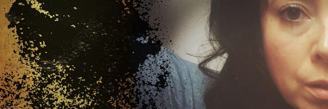 Living With Binge Eating Disorder: Here Are 7 Things That Help A woman