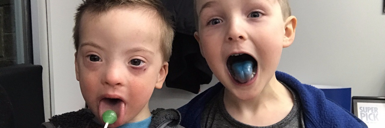 Two brothers, one with Down syndrome and he is licking a green sucker, his borther by his side is showing his blue tongue from a sucker.