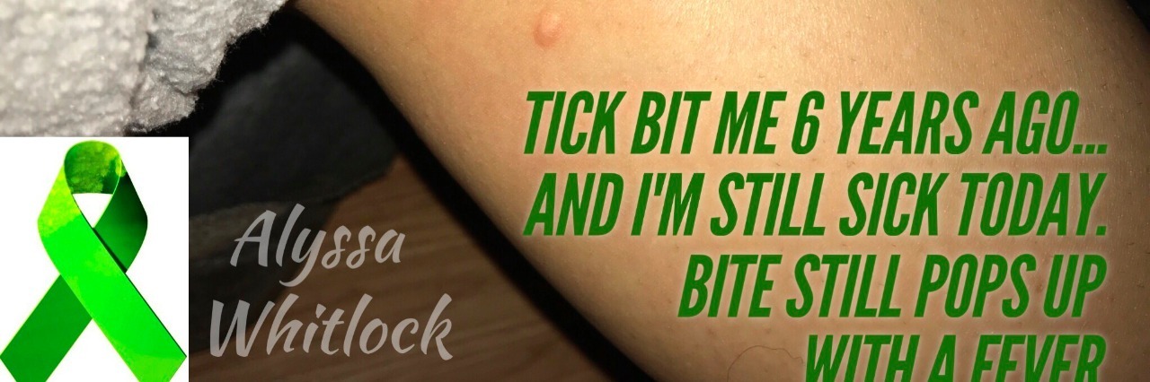 finger pointing to spot on leg with text chronic lyme disease exists and we need a cure