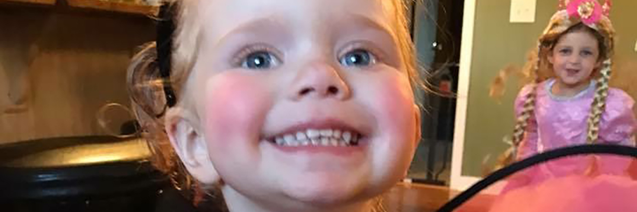 Parenting a Child With Amniotic Band Syndrome Sarah Glover's daughter.