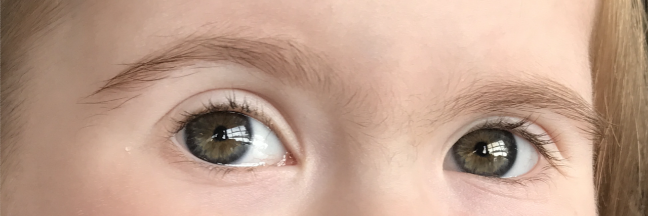 My Daughter's Almond Shaped Eyes Show Me Different Is Beautiful