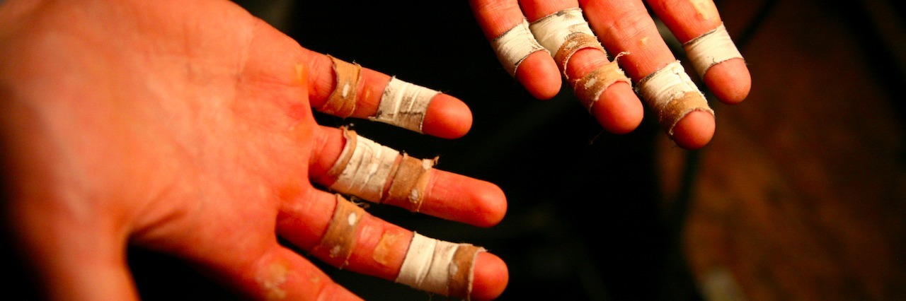 What My Life Is Like as a Man With Dermatophagia Hands with bandages