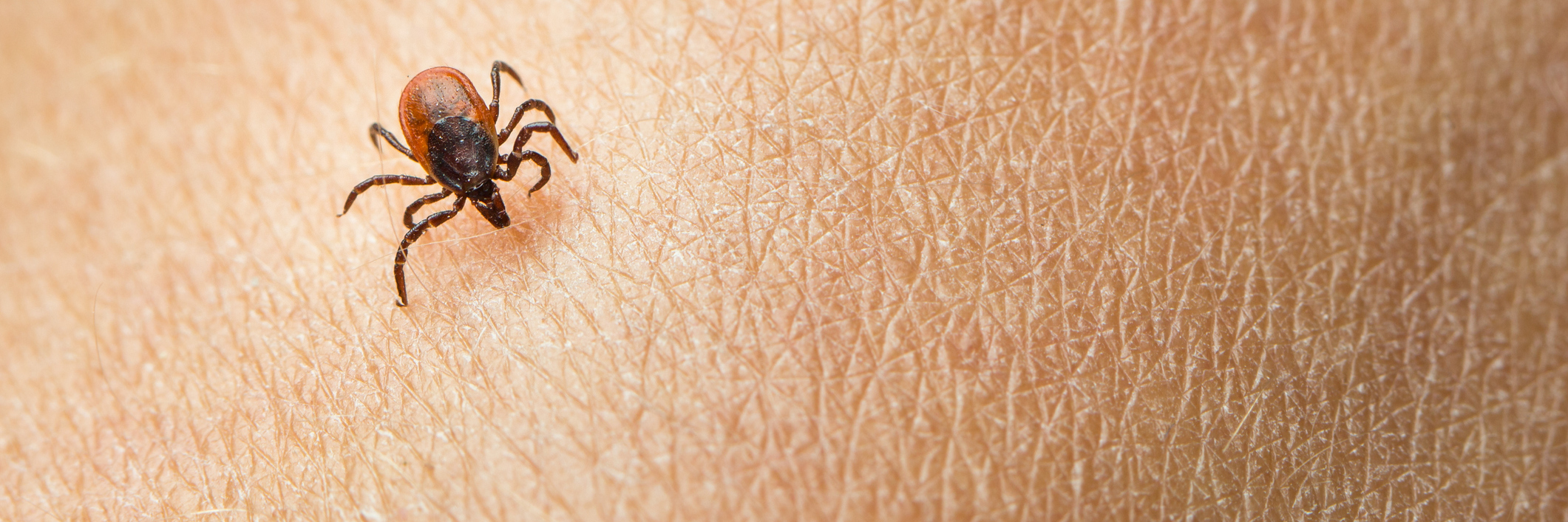 tick crawling on a person's skin