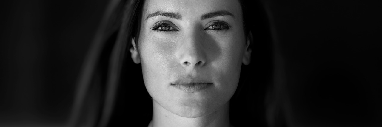 Sjogren's Syndrome: Hiding Pain Behind Stern Expression