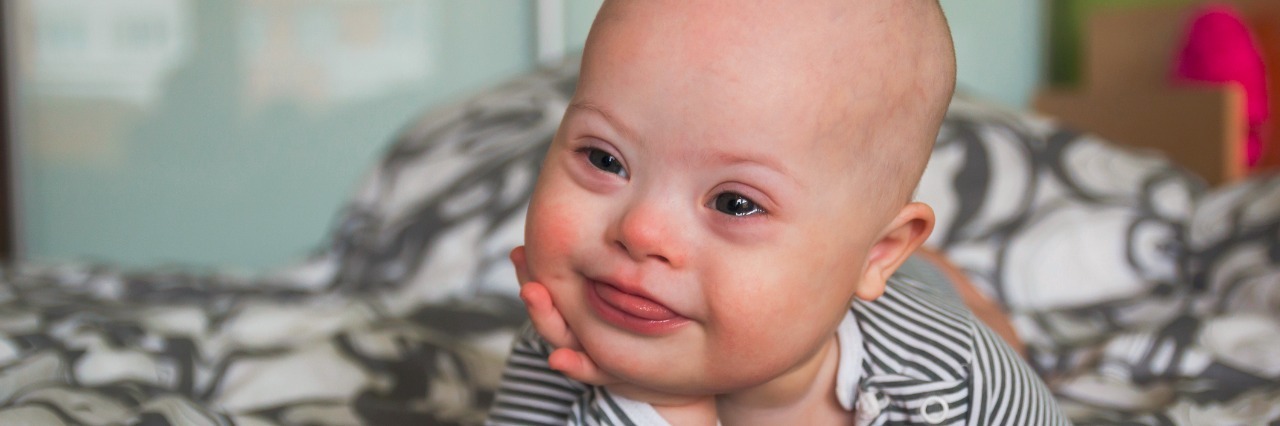 Fixing the System Against Down Syndrome Prenatal Testing
