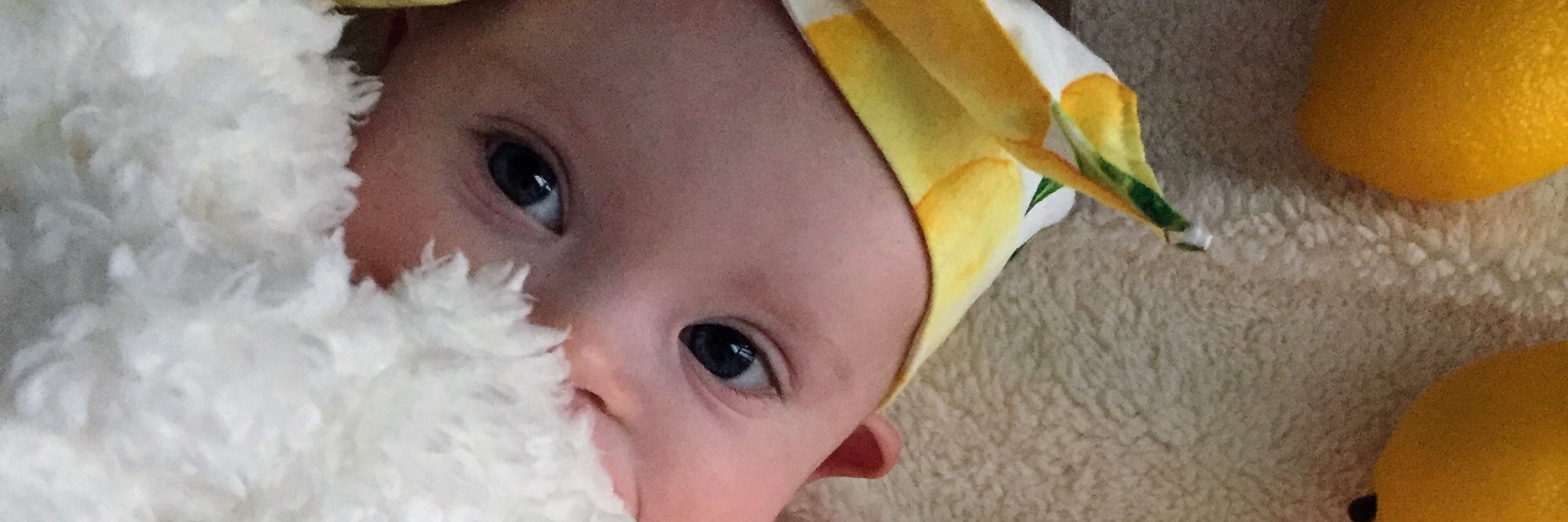 When a Little Girl Made a Joke About Having 'Special Needs' Little girl with Down syndrome wearing a yellow bow on her head and a white blanket covering her mouth, as if she was playing "pick-a-boo"