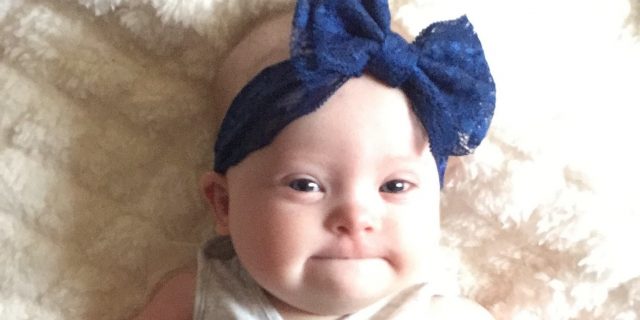 One Year After Our Prenatal Diagnosis of Down Syndrome