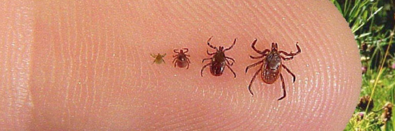 Preventing Tick Bites, Infection, Lyme Disease finger with several tiny ticks on it