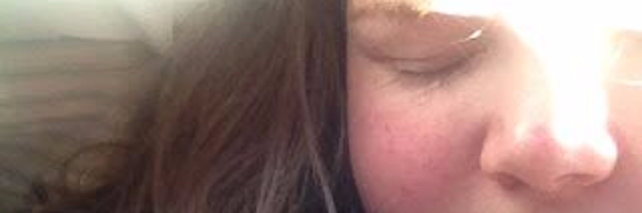 Lupus: Not Bottling Up Emotions, Processing Feelings young woman sleeping in the sun