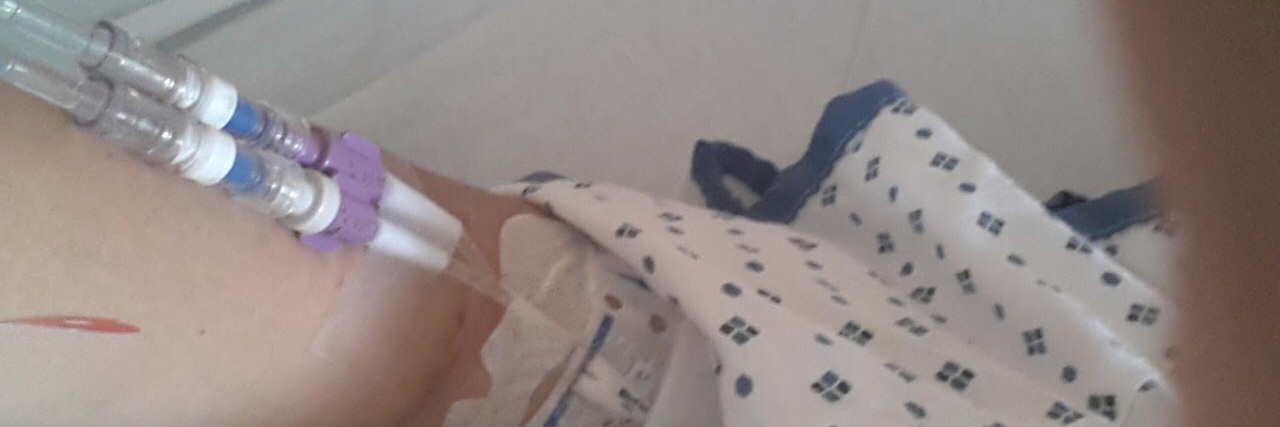 Being Misdiagnosed With Diabetes Type 2 Instead of Type 1 woman in the hospital with an IV in her arm